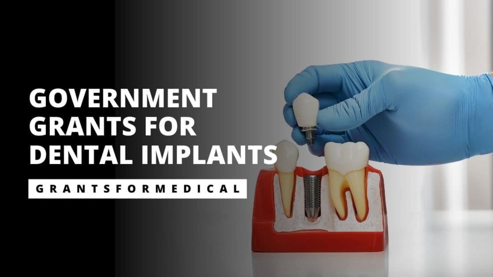 Grants for Dental Implants